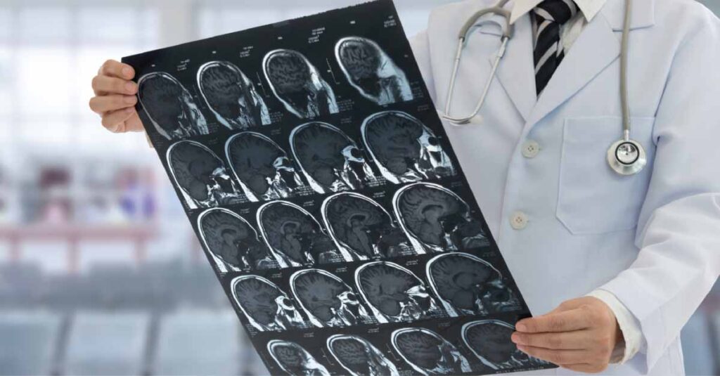 When to See a Neurologist